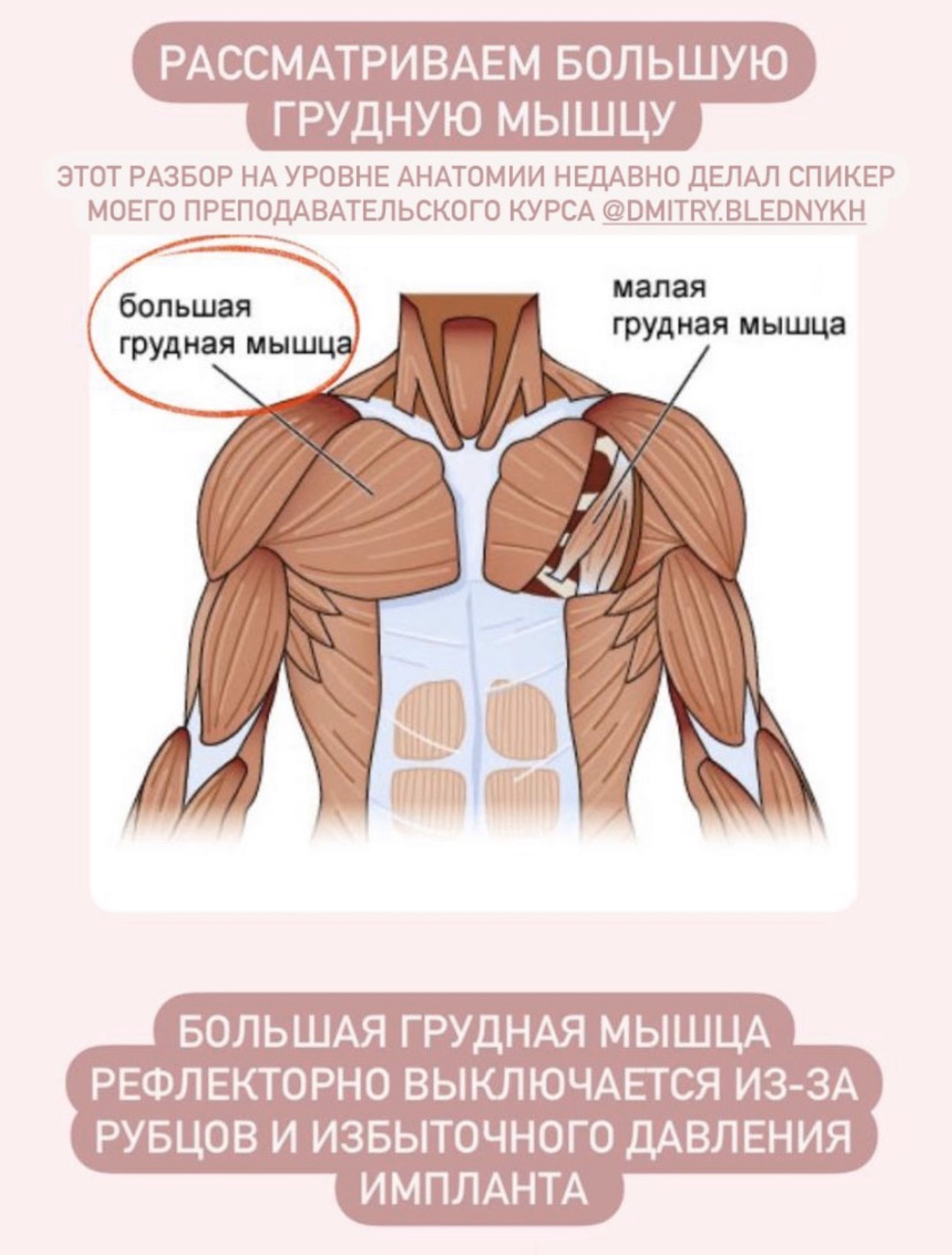 Как бюстгальтер и силиконовая грудь влияют на женское здоровье - Kundalini  Yoga